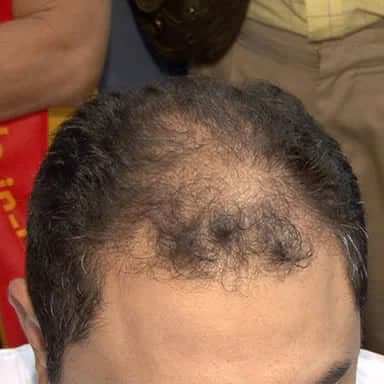 Before using Asha Fiber