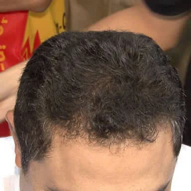 After using Asha Fiber