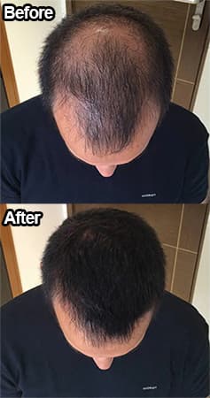 Before and after coverage of thinning at the crown
